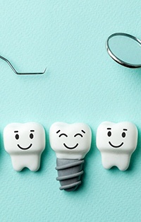 Illustration of dental implants in Southlake