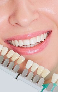 Patient comparing smile to tooth color chart